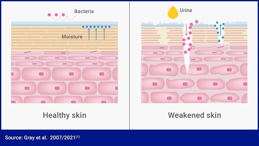 When the pH value of the skin protection barrier increases, bacteria can penetrate the skin