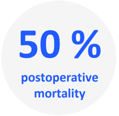 Icon of 50% postoperative mortality