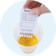 Drugs zelftest - stap 2 - vang verse urine op in een beker